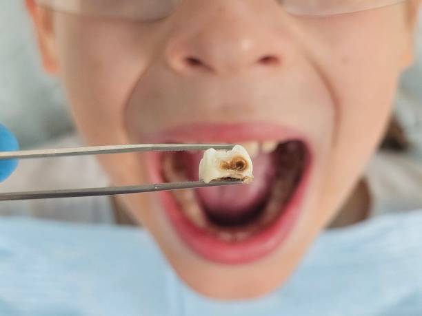 Best Orthodontic Emergency Dentist in Benton, TN