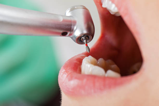 Best Emergency Dental Services for Seniors in Benton, TN